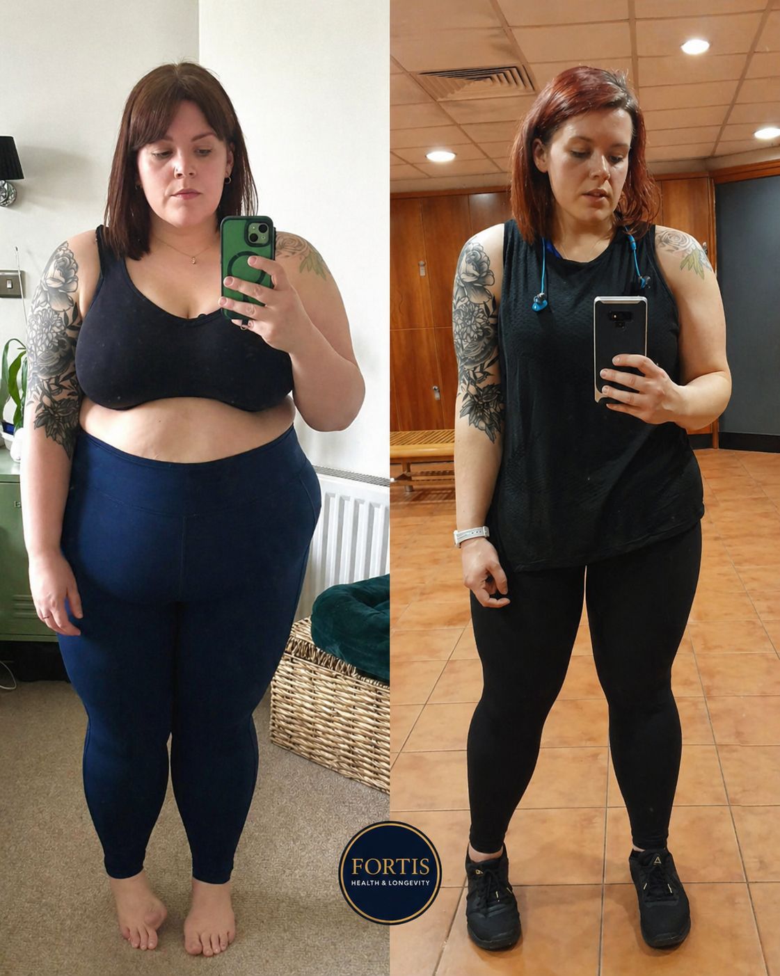 Nell — Weight Loss, Post Shoulder Dislocation